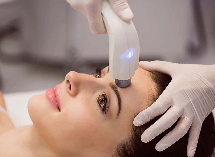 Endolift Lazer